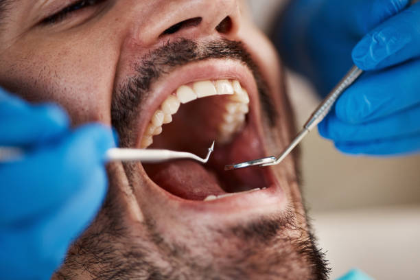 Best Walk-In Emergency Dental Services in New Martinsville, WV